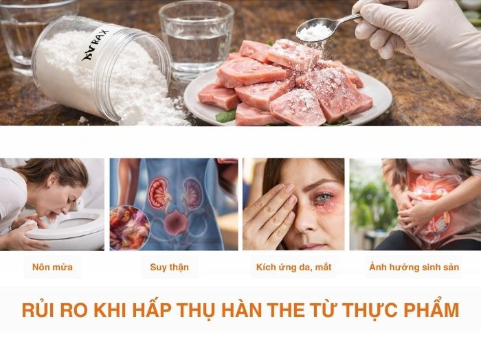 Rủi ro khi hấp thụ hàn the từ thực phẩm
